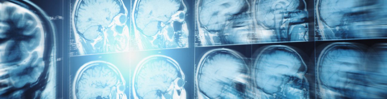 Compensation in Injury Cases: Onshore